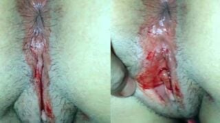 Indian Village Girl Defloration Video